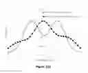 Fig. 134 - Lenses, devices, systems and methods for refractive error