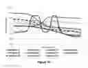 Fig. 77 - Lenses, devices, systems and methods for refractive error
