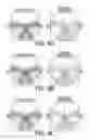 Fig. 09 - MANUFACTURING APPARATUS AND MANUFACTURING METHOD FOR SPECTACLE LENS