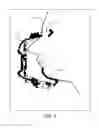 Fig. 08 - Virtual mask alignment for fit analysis