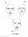 Fig. 30 - Virtual mask alignment for fit analysis