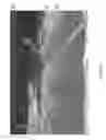 Fig. 10 - Vehicle vision system with retroreflector pattern recognition