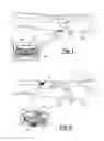 Fig. 02 - System for detecting image abnormalities