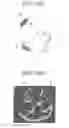 Fig. 22 - Image processing device and storage medium for image processing