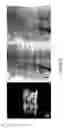 Fig. 10 - Method and system for tomosynthesis imaging