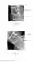 Fig. 03 - Method and apparatus for measuring rotation parameters of a spine on medical images