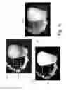 Fig. 07 - Geodesic saliency using background priors