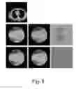 Fig. 09 - Iterative CT image reconstruction of a ROI with objects outside the scan FoV