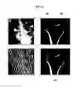 Fig. 07 - Apparatus and method for reconstructing skeletal image