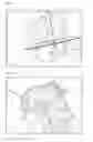 Fig. 03 - METHOD OF OPERATING A SURGICAL NAVIGATION SYSTEM AND A SYSTEM USING THE SAME