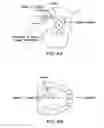 Fig. 05 - Methods and devices for intraoral tactile feedback