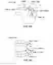 Fig. 06 - Methods and devices for intraoral tactile feedback