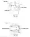 Fig. 10 - Methods and devices for intraoral tactile feedback