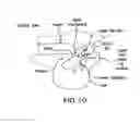 Fig. 11 - Methods and devices for intraoral tactile feedback