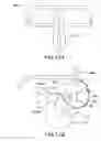 Fig. 18 - Methods and devices for intraoral tactile feedback