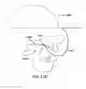 Fig. 19 - Methods and devices for intraoral tactile feedback