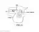 Fig. 24 - Methods and devices for intraoral tactile feedback