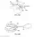 Fig. 25 - Methods and devices for intraoral tactile feedback
