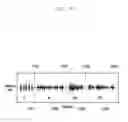 Fig. 11 - Method and apparatus for managing audio signals