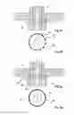 Fig. 03 - Rotating anode mount adaptive to thermal expansion