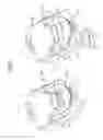Fig. 04 - Ion milling device