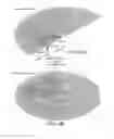 Fig. 05 - Faraday Shield Having Plasma Density Decoupling Structure Between TCP Coil Zones