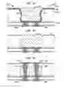 Fig. 22 - Stacked microelectronic assembly with TSVS formed in stages and carrier above chip