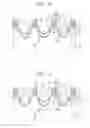 Fig. 13 - Semiconductor device having stressor and method of forming the same