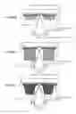 Fig. 08 - Multiple-surface imposition vapor deposition mask