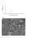 Fig. 03 - Lithium titanate particles and process for producing the lithium titanate particles, Mg-containing lithium titanate particles and process for producing the Mg-containing lithium titanate particles, negative electrode active substance particles for non-aqueous electrolyte secondary batteries, and non-aqueous electrolyte secondary battery