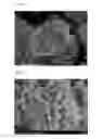 Fig. 04 - Precursor for preparation of lithium composite transition metal oxide, method for preparing the same and lithium composite transition metal oxide obtained from the same