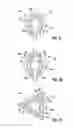 Fig. 07 - CONTACT ELEMENT AND METHOD FOR PRODUCING A CONTACT ELEMENT