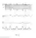 Fig. 22 - Amplifier dynamic bias adjustment for envelope tracking