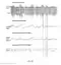 Fig. 32 - Amplifier dynamic bias adjustment for envelope tracking