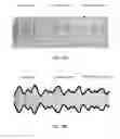 Fig. 33 - Amplifier dynamic bias adjustment for envelope tracking