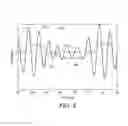 Fig. 05 - Hearing implant bilateral matching of ILD based on measured ITD
