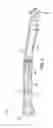 Fig. 07 - Grain cart with folding auger