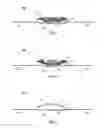 Fig. 03 - Equine shoe