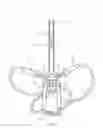 Fig. 03 - Electronic Hookah System