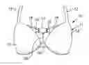 Fig. 01 - Brassiere accessory