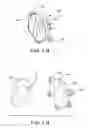 Fig. 06 - Brassiere accessory