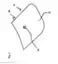 Fig. 02 - Sleep apnea prevention mask