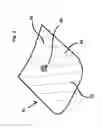 Fig. 03 - Sleep apnea prevention mask
