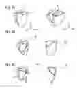 Fig. 06 - PRESERVED FLOWER ARRANGEMENT AND METHOD FOR PRODUCING THE SAME
