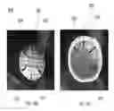Fig. 21 - Helmet padding system