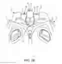 Fig. 03 - Cord Lock Fit System for a Helmet
