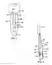 Fig. 03 - Lace securement device