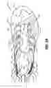 Fig. 15 - Articles of footwear