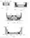 Fig. 03 - Pattern assembly