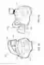 Fig. 11 - BITE PROOF STRAW ASSEMBLY